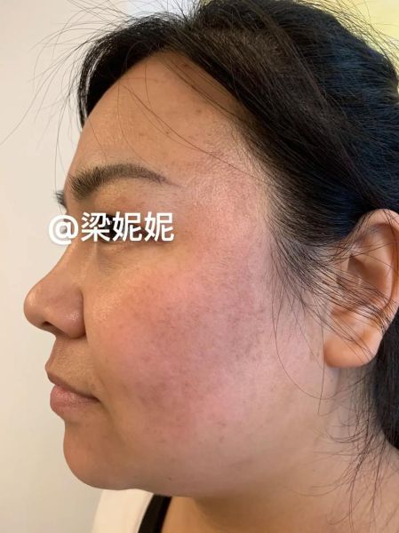 花斑斑表达什么情感_花斑斑暗示什么心理